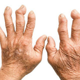 Rheumatology for the Sports Physician