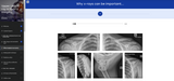 Upper Limb Xray in Sports Imaging