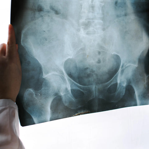 Examination of the Hip, Groin & Buttock